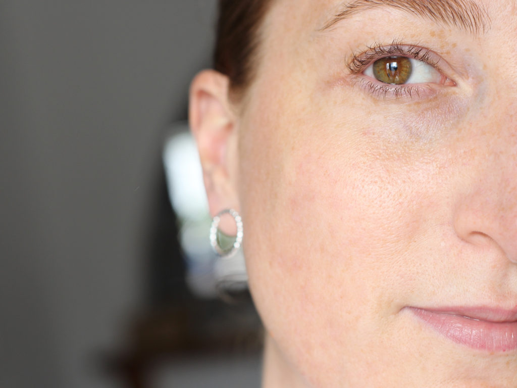 effet traitement roaccutane bilan final